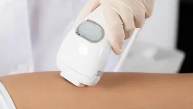 مركز سيلكور لإزالة الشعر بالليزر