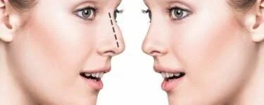 أفضل دكتور تجميل للوجه في دبي